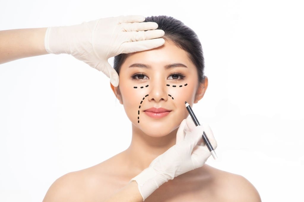 Mujer joven marcada con un lápiz antes del tratamiento con ácido hialurónico