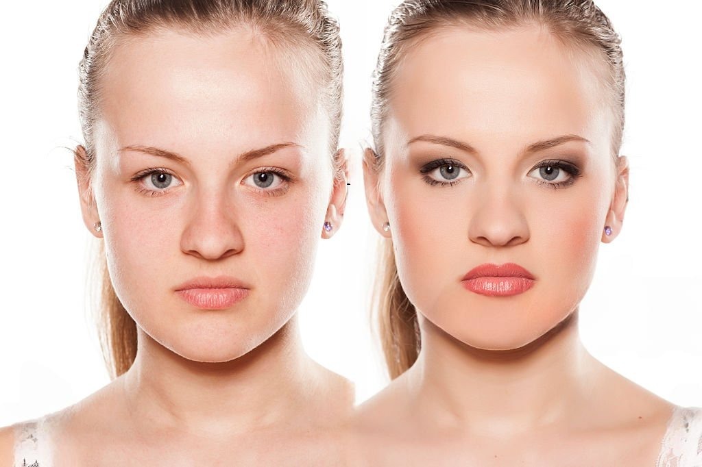 Antes y después de que una joven mujer reciba el tratamiento de voluminización