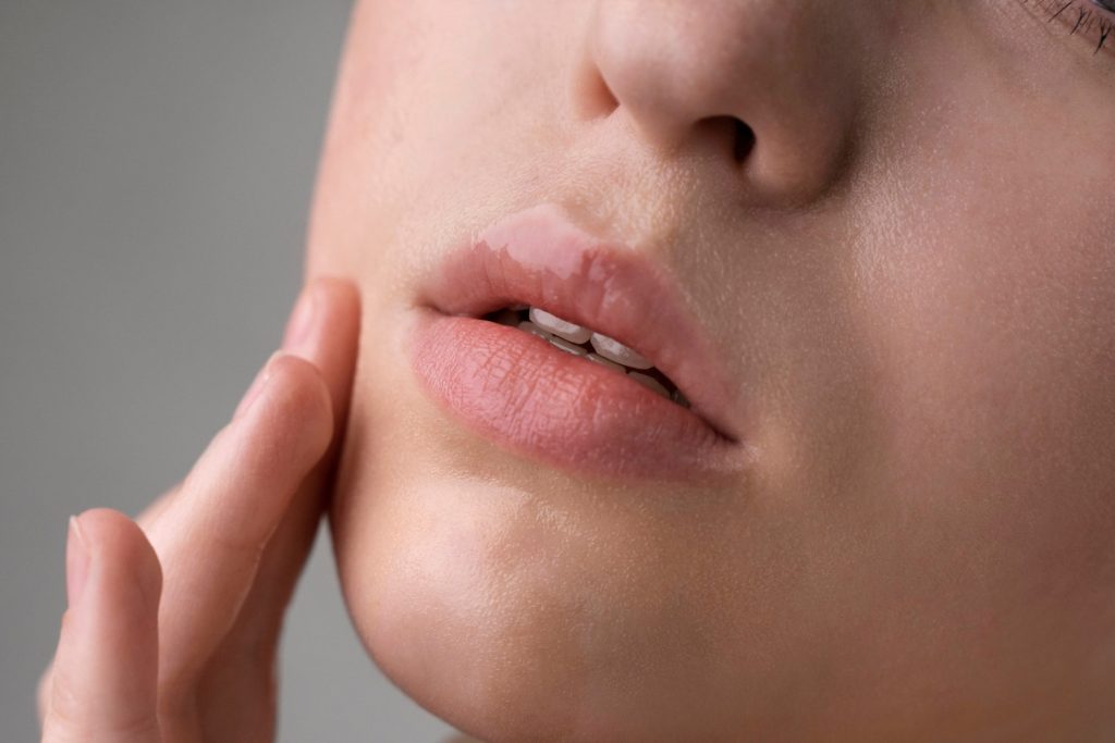 labios de mujer que ha recibido tratamiento de relleno facial con ácido hialurónico