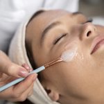 Mujer recibiendo tratamiento de Peeling facial